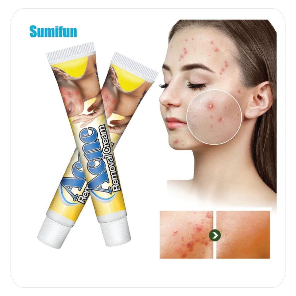 Crema Antiacné Sumifun 30g